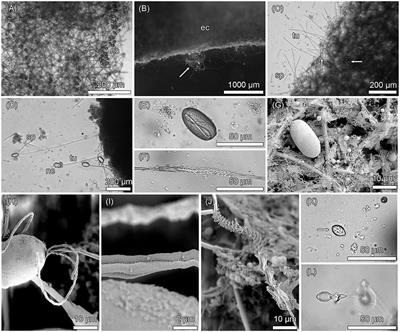 The Precursor Hypothesis of Sponge Kleptocnidism: Development of Nematocysts in Haliclona cnidata sp. nov. (Porifera, Demospongiae, Haplosclerida)